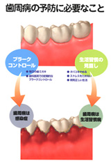 歯周病ってどんな病気？