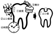 ムシ歯はなぜできるのでしょう？